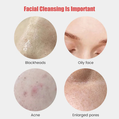 Sonic Silicone Facial Cleanser
